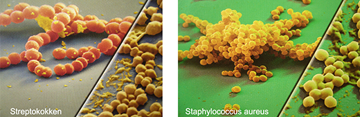 Staphylococcus