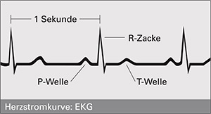 EKG - grafische Darstellung