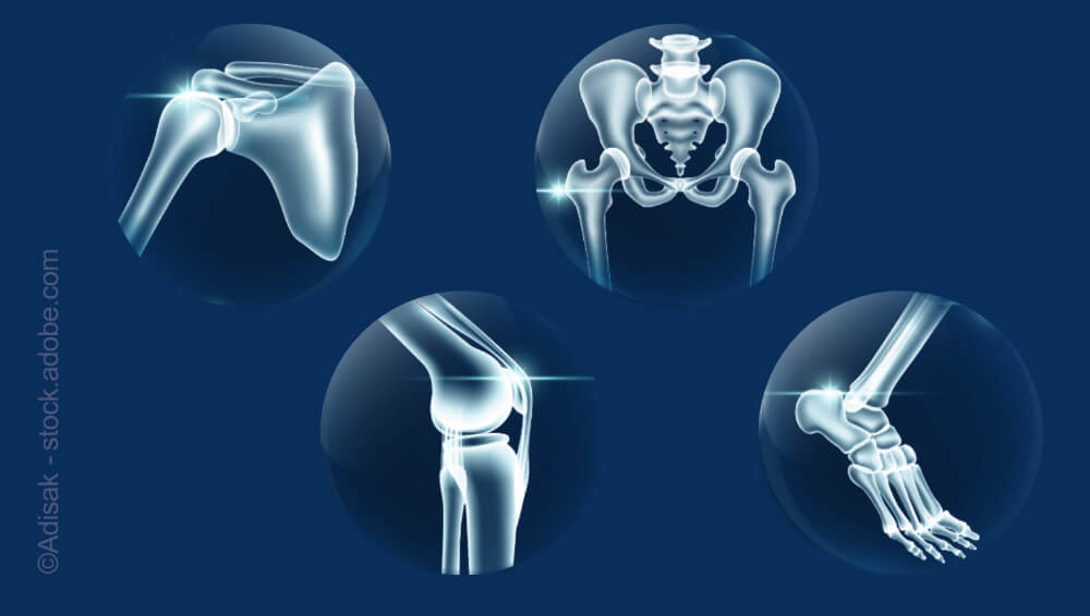 Medizintechnik Implantate