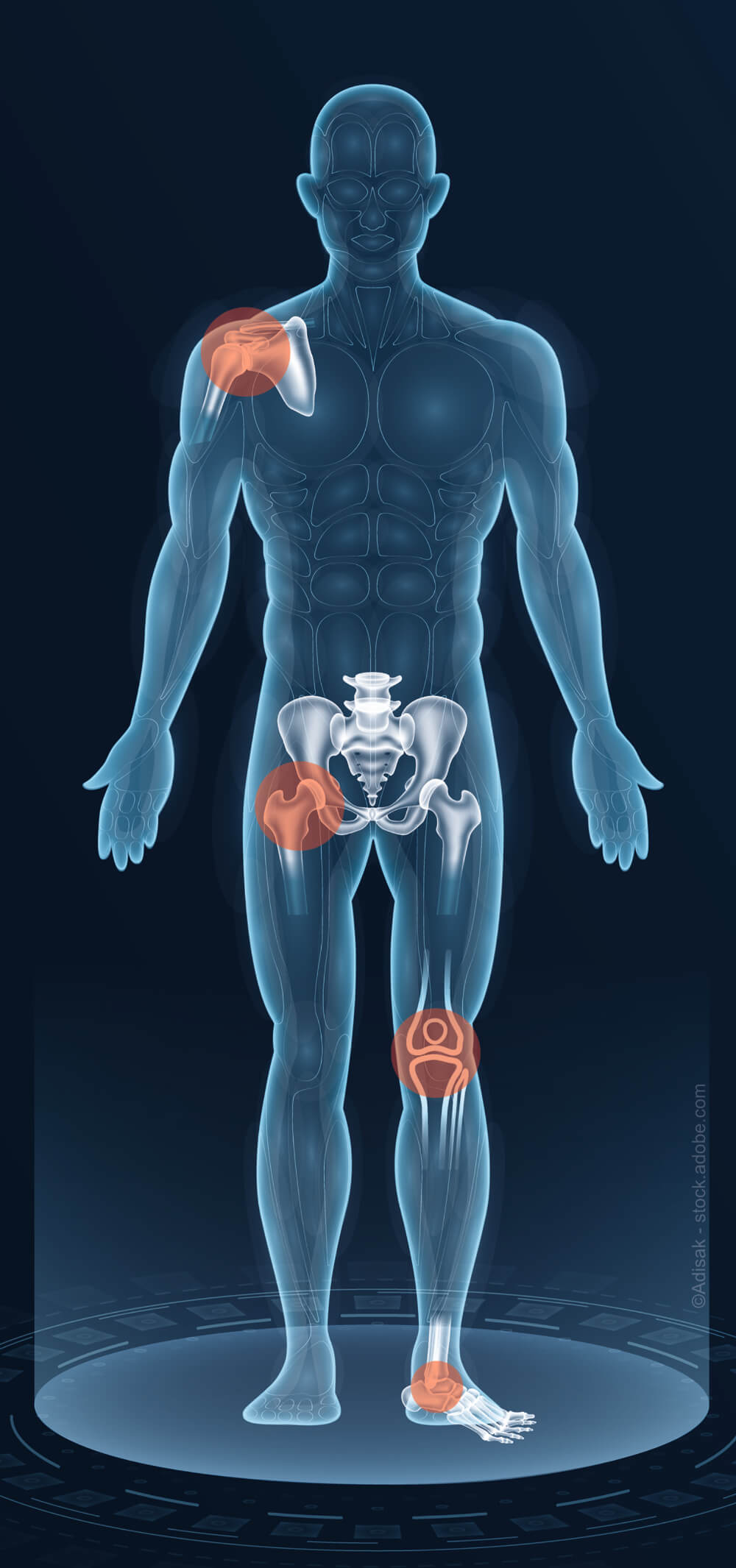 Schema Mensch Traumatologie Orthopädie