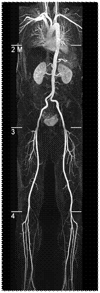 MR-Angiographie