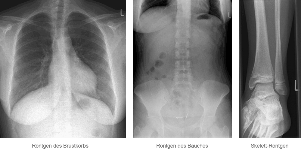 Röntgenaufnahmen